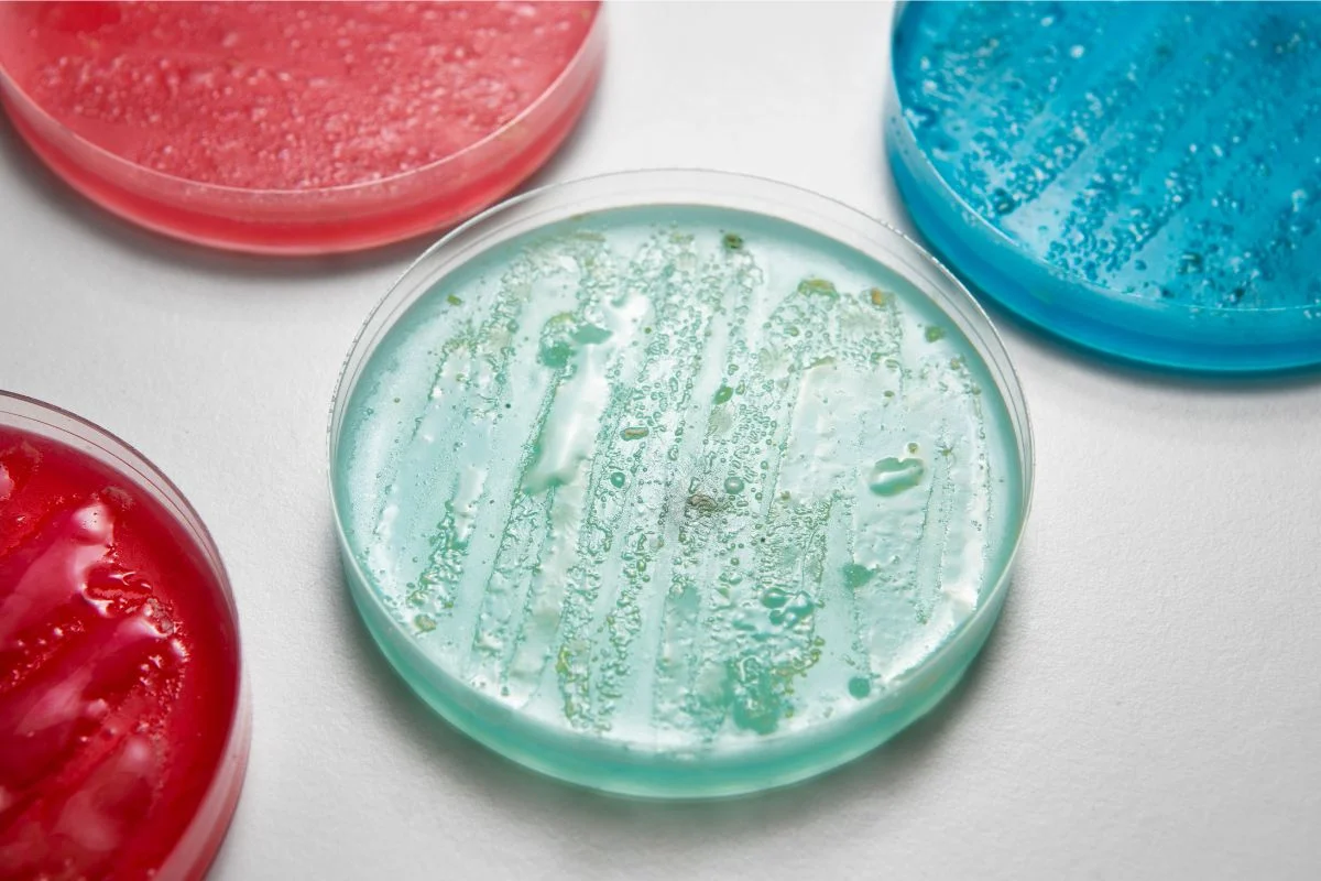 Mikrobiologické znečistenie vody